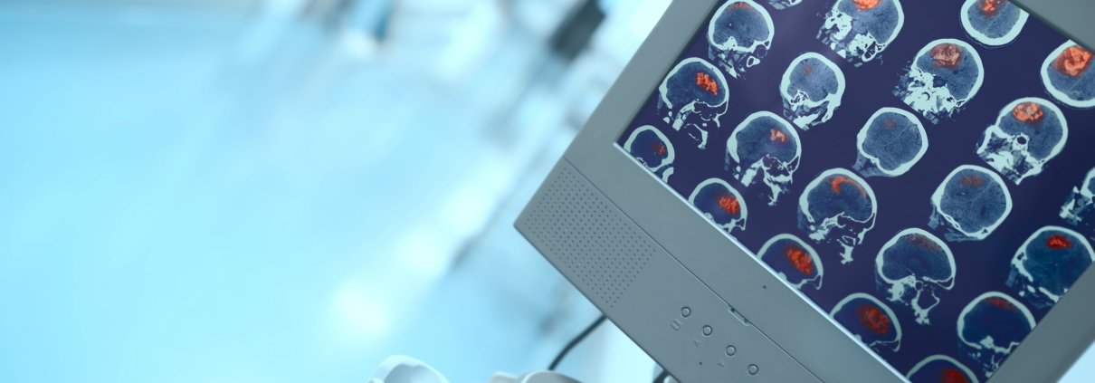 Bronx Brain injury Attorney