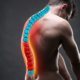 Herniated Disc or a Back Injury from a Car Crash