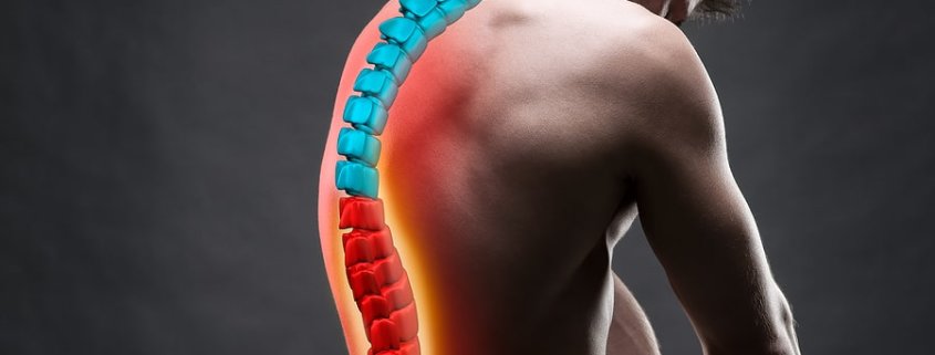 Herniated Disc or a Back Injury from a Car Crash